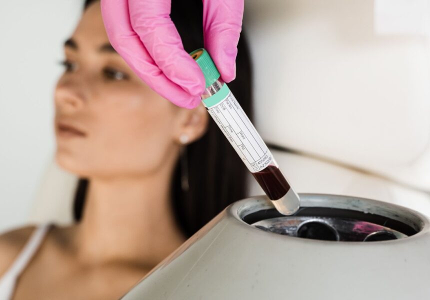 prp-capilar-bekalon